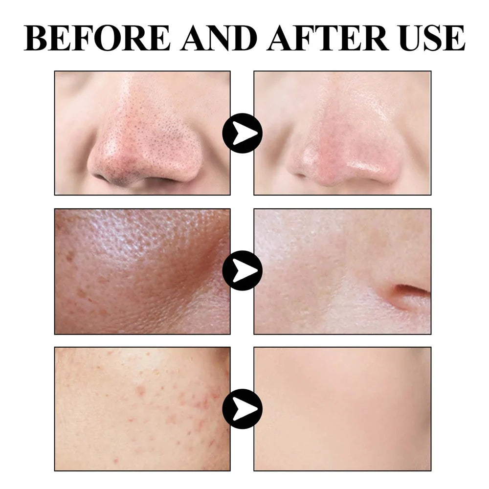 West & Month Blackhead Removal Mud Face Mask