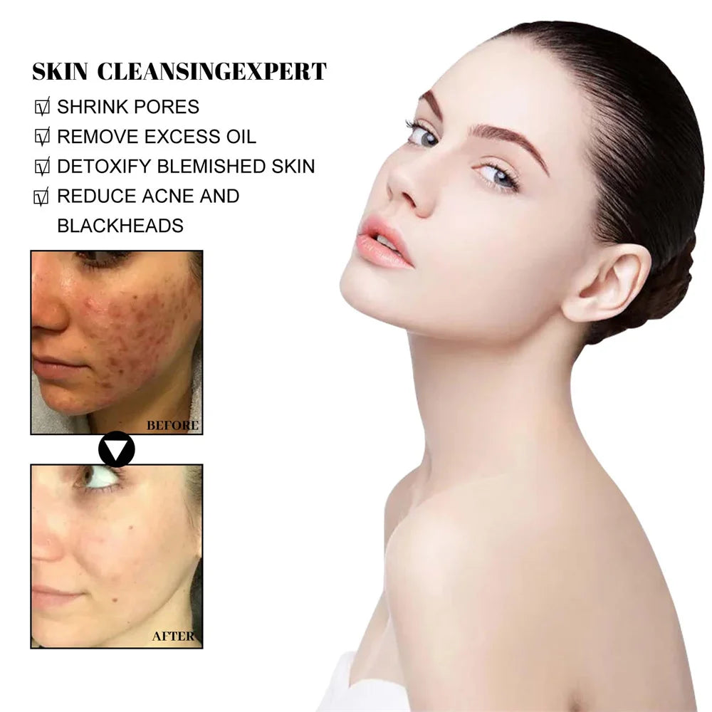 West & Month Blackhead Removal Mud Face Mask